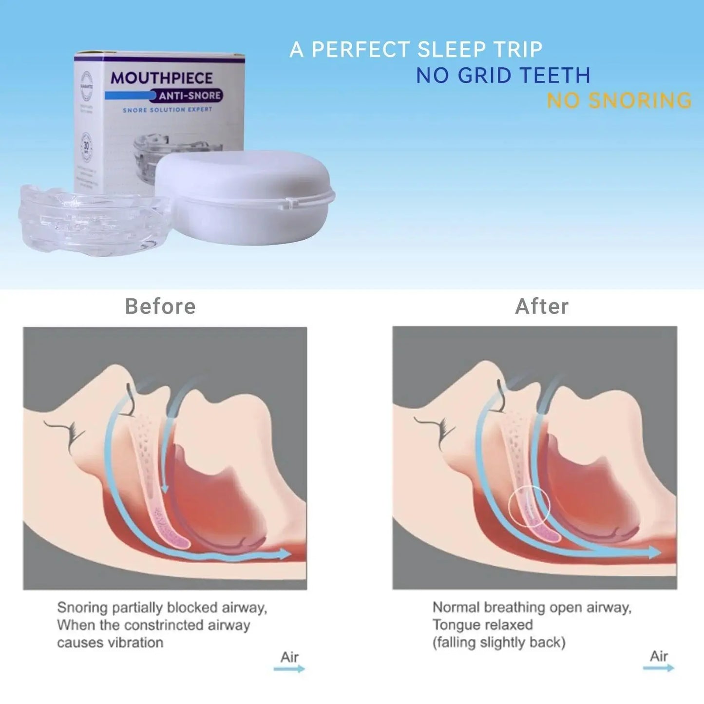 Aelithora Anti-Snoring Mouthpiece