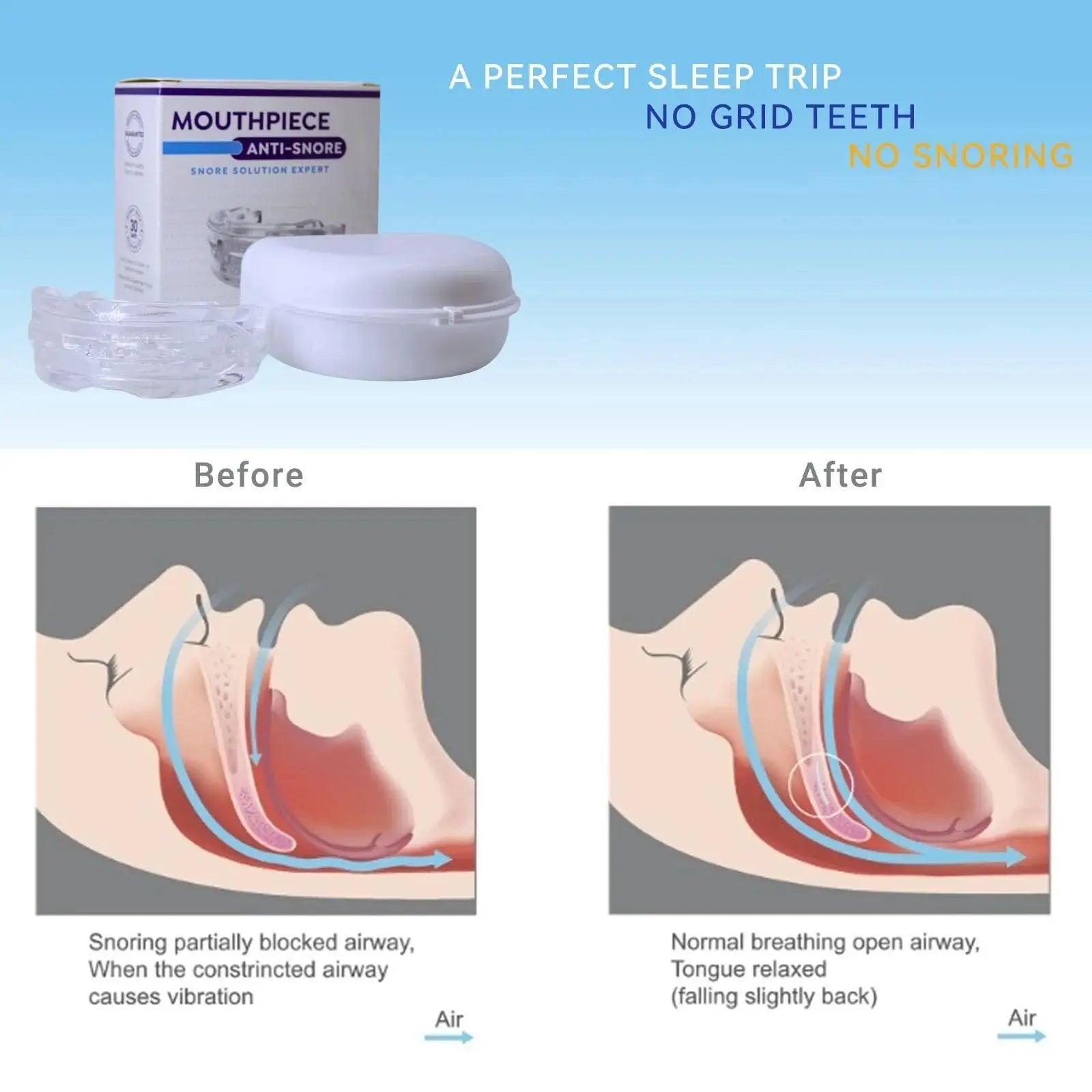 Aelithora Anti-Snoring Mouthpiece